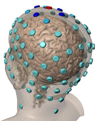 Marom Bikson Brain Stimulation Research